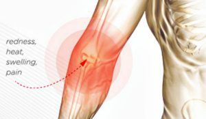 4 Foods That Reduce Inflammation In The Body