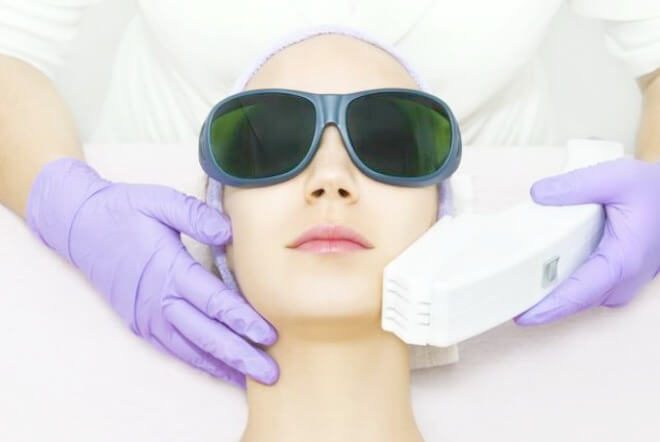 Laser When Is It The Best Time To Have This Treatment