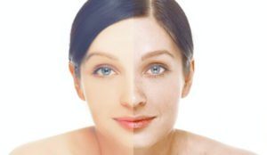 Retinoids In Skin Care Are They Friend Or Foe For Use On The Skin