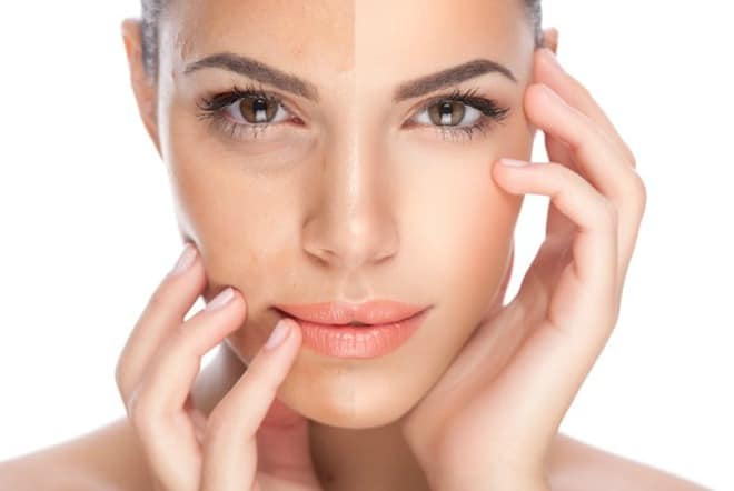 Skin rejuvenation here are the top 5 treatments to look out for