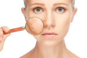 Acid On Your Face Is This The Secret To Amazing Skin