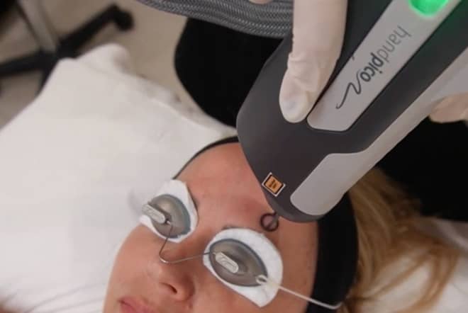 Ablative lasers VS non-ablative lasers: What’s the difference?