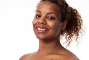 Sensitive skin Is your skin really sensitive or are you just sensitised