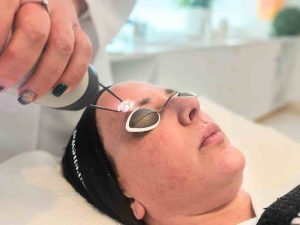 The Lowdown on PICO Laser: Why the Next-Gen Treatment?