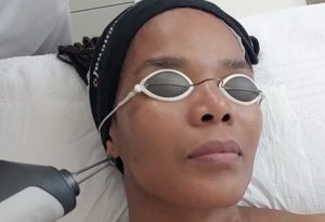 PICO Laser: When Laser Loves Your Skin Type 