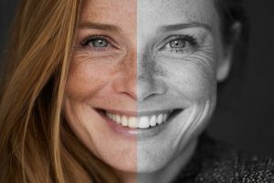 Biorevitalisation: Why You'll Love This Next-Gen Volumiser