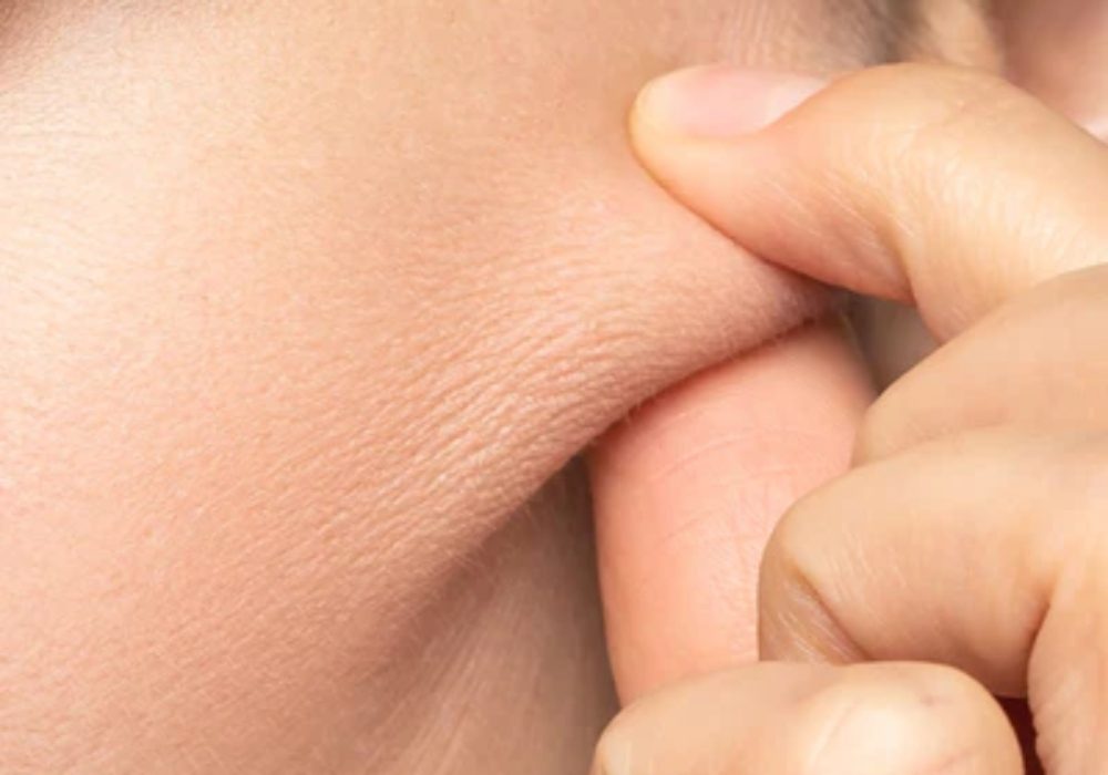 Collagen: The Building Blocks of Your Skin