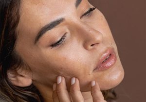 Melasma and the Basement Membrane: What's The Secret?